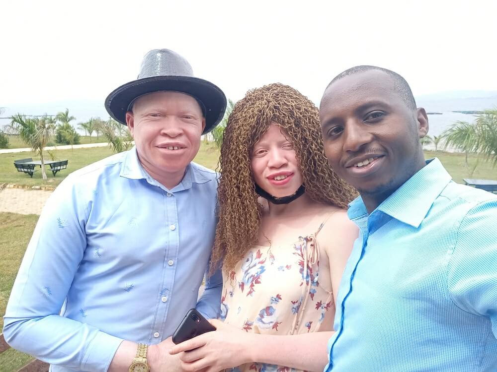 miklah for albinism